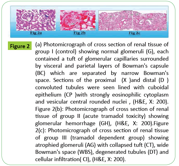 toxicology-glomerular-capillaries