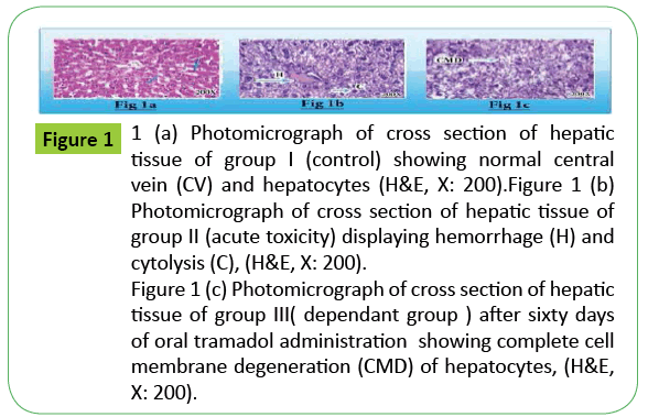 toxicology-hepatic-tissue