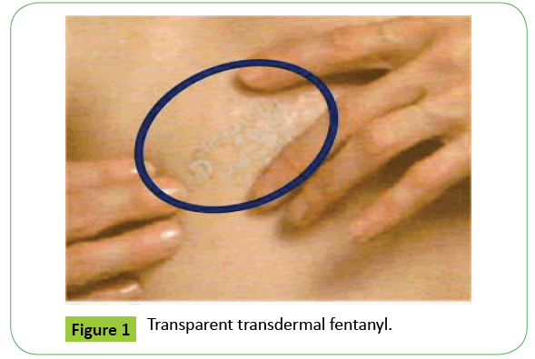 Image of durogesic d-trans dermal patch 50 mcg-hr