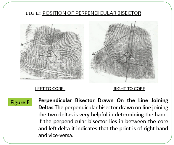 toxicology-Perpendicular-Bisector