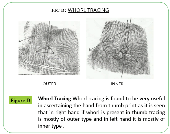 toxicology-Whorl-tracing