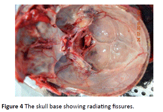 toxicology-radiating-fissures